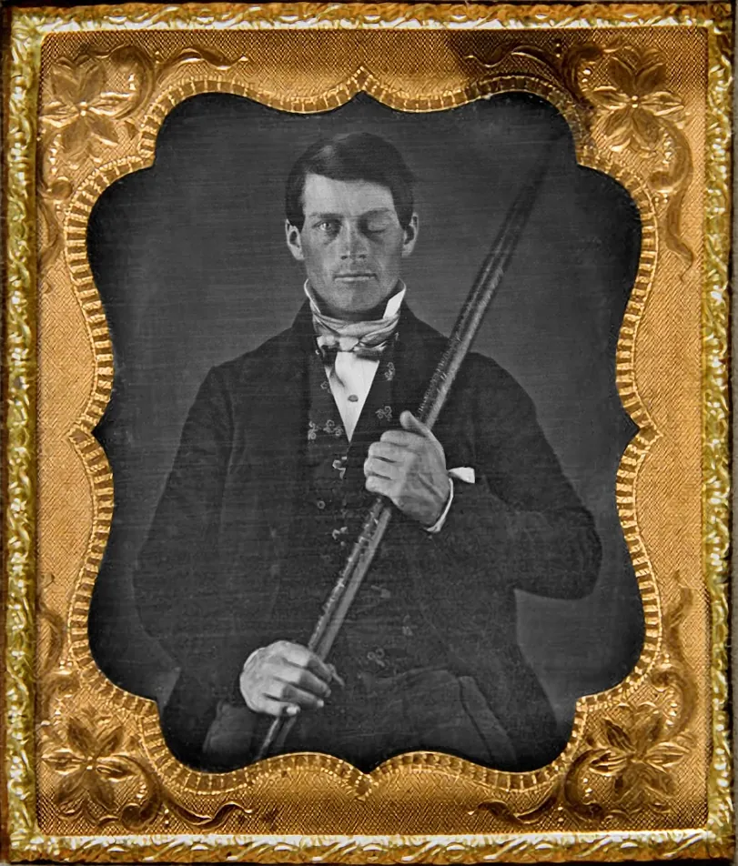 Phineas Gage, photo 1 of 2