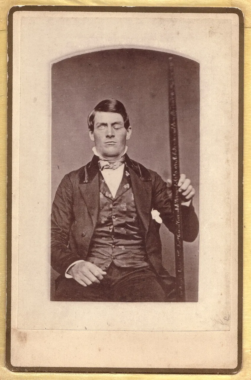 Phineas Gage, photo 2 of 2